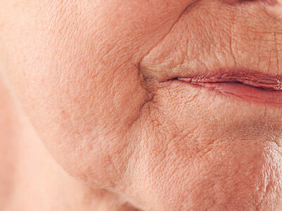 Senior female face with wrinkled skin