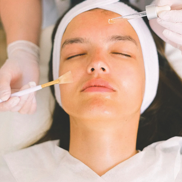 Chemical Peel to Increase Collagen Production Antiaging Milwaukee Skincare