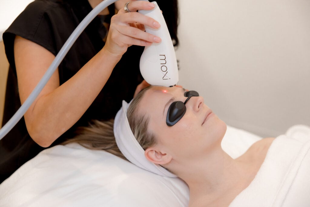 summer event prep facial