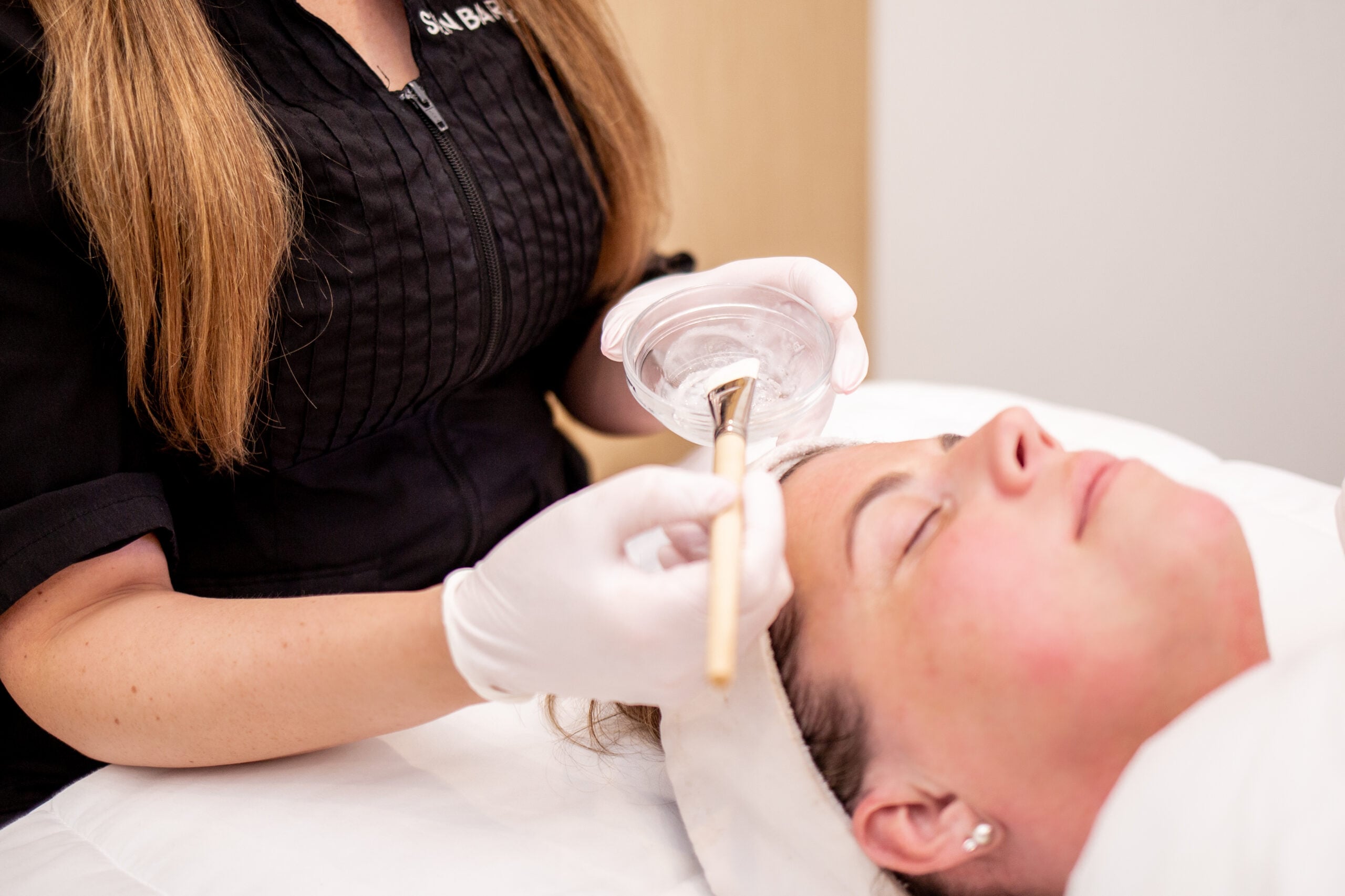 Chemical peels